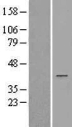 Novus Biologicals™ AKR1D1 Overexpression Lysate