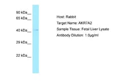 AKR7A2 Antibody, Novus Biologicals 100 &mu;L | Buy Online | Novus Biologicals | Fisher Scientific