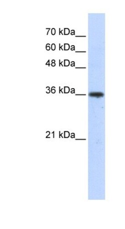 AKR7A3 Antibody, Novus Biologicals:Antibodies:Primary Antibodies