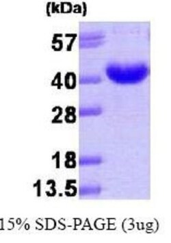 Novus Biologicals&trade;&nbsp;Recombinant Human AKR7A3 His Protein
