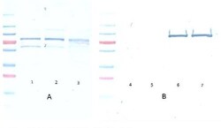 AKT1, p Ser473 Antibody (17F6.B11), Novus Biologicals 0.1mg; Unlabeled:Antibodies,