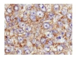 AKT1, p Ser473 Antibody, Novus Biologicals 0.1mg; Unlabeled:Antibodies,