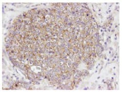 AKT1, p Ser473 Antibody, Novus Biologicals 0.1mg; Unlabeled:Antibodies,