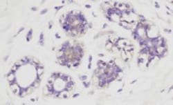 AKT1, p Ser473 Antibody, Novus Biologicals 0.1mg; Unlabeled:Antibodies,