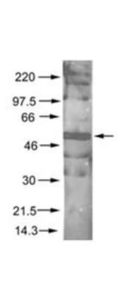AKT1, p Ser473 Antibody, Novus Biologicals 0.1mg; Unlabeled:Antibodies,