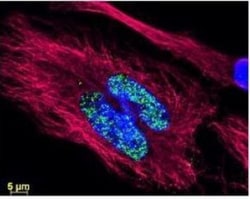 AKT1, p Thr308 Antibody (18F3.H11), Novus Biologicals 0.1mg; Unlabeled:Antibodies,