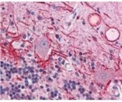 AKT1, p Thr308 Antibody (18F3.H11), Novus Biologicals 0.1mg; Unlabeled:Antibodies,