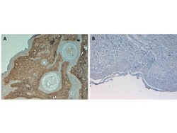 AKT1, p Thr308 Antibody (18F3.H11), Novus Biologicals 0.1mg; Unlabeled:Antibodies,