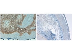 AKT1, p Thr308 Antibody (18F3.H11), Novus Biologicals 0.1mg; Unlabeled:Antibodies,