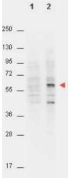 AKT1, p Thr308 Antibody (18F3.H11), Novus Biologicals 0.1mg; Unlabeled:Antibodies,