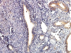 AKT1 Antibody (3A3), Novus Biologicals 0.1mL; Unlabeled:Antibodies, Monoclonal