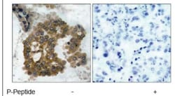 AKT2, p Ser474 Antibody, Novus Biologicals:Antibodies:Primary Antibodies
