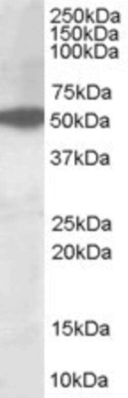 AKT3 Antibody, Novus Biologicals 0.1mg; Unlabeled:Antibodies, Polyclonal