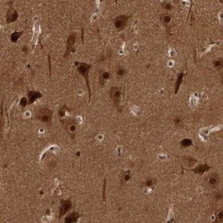 AKT3 Antibody, Novus Biologicals 25 &mu;L; Unlabeled:Antibodies, Polyclonal