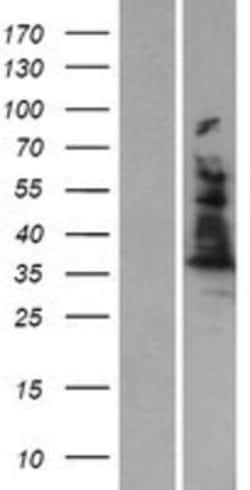 Novus Biologicals&trade;&nbsp;ALAD Overexpression Lysate