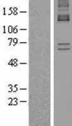 Novus Biologicals&trade;&nbsp;Alas1 Overexpression Lysate