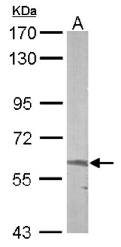 ALAS2 Antibody, Novus Biologicals 0.1mg; Unlabeled:Antibodies, Polyclonal