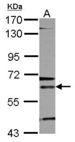 ALAS2 Antibody, Novus Biologicals 0.1mg; Unlabeled:Antibodies, Polyclonal