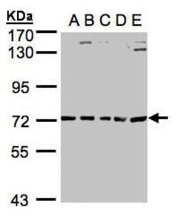 ALAS2 Antibody, Novus Biologicals 0.1mg; Unlabeled:Antibodies, Polyclonal