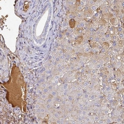 Albumin Antibody, Novus Biologicals 0.1mL; Unlabeled:Antibodies, Polyclonal