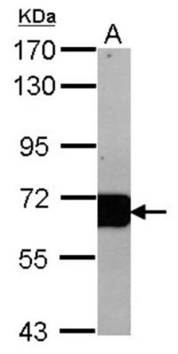 Albumin Antibody, Novus Biologicals 0.1mg; Unlabeled:Antikörper