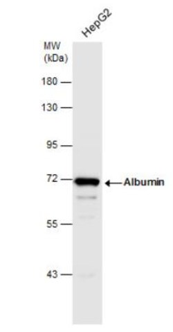 Albumin Antibody, Novus Biologicals 0.1mg; Unlabeled:Antikörper