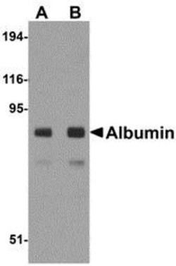 Albumin Antibody - BSA Free, Novus Biologicals 0.1mg; Unlabeled:Antibodies,
