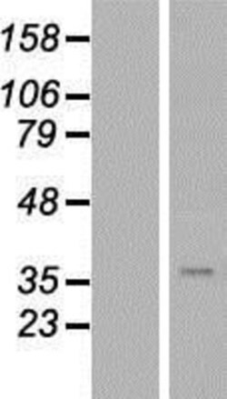 Novus Biologicals&trade;&nbsp;alcohol dehydrogenase 1A Overexpression Lysate