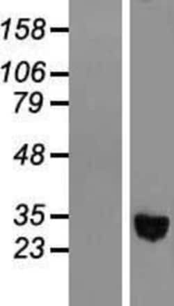 Novus Biologicals™ alcohol dehydrogenase 1C Overexpression Lysate