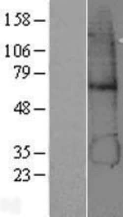 Novus Biologicals&trade;&nbsp;alcohol dehydrogenase 5 Overexpression Lysate