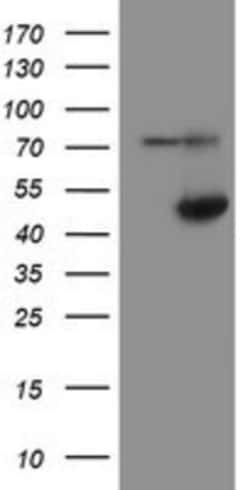 alcohol dehydrogenase 7 Antibody (OTI2H10), Novus Biologicals 0.1mL; Unlabeled:Antibodies,