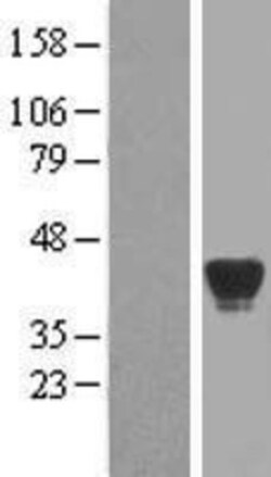 Novus Biologicals&trade;&nbsp;alcohol dehydrogenase 7 Overexpression Lysate