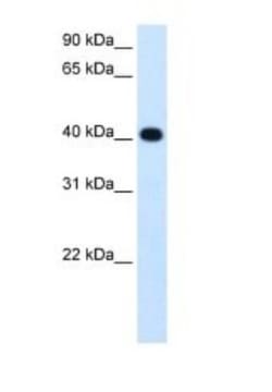 alcohol dehydrogenase 4 Antibody, Novus Biologicals 100&mu;L; Unlabeled:Antibodies,