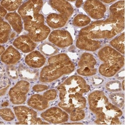 alcohol dehydrogenase 5 Antibody, Novus Biologicals:Antibodies:Primary