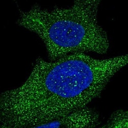 alcohol dehydrogenase 7 Antibody, Novus Biologicals:Antibodies:Primary
