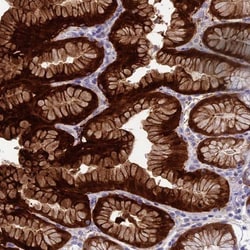 alcohol dehydrogenase 7 Antibody, Novus Biologicals:Antibodies:Primary