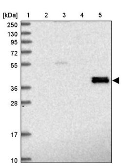 alcohol dehydrogenase 7 Antibody, Novus Biologicals:Antibodies:Primary