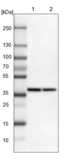 alcohol dehydrogenase 7 Antibody, Novus Biologicals:Antibodies:Primary