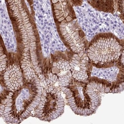 Aldehyde Dehydrogenase 3-A1/ALDH3A1 Antibody, Novus Biologicals:Antibodies:Primary