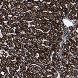 Aldehyde dehydrogenase 5 Antibody, Novus Biologicals:Antibodies:Primary