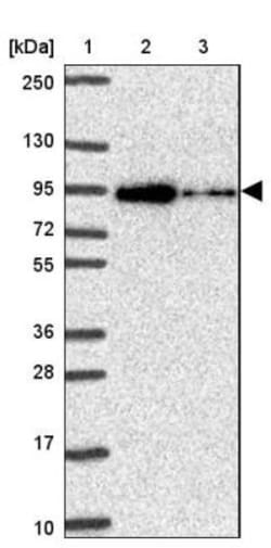 ALDH16A1 Antibody, Novus Biologicals 25 &mu;L, Unlabeled:Antibodies, Polyclonal