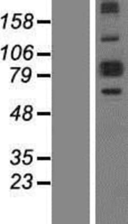 Novus Biologicals&trade;&nbsp;ALDH18A1 Overexpression Lysate