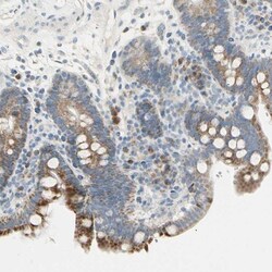 ALDH18A1 Antibody, Novus Biologicals:Antibodies:Primary Antibodies