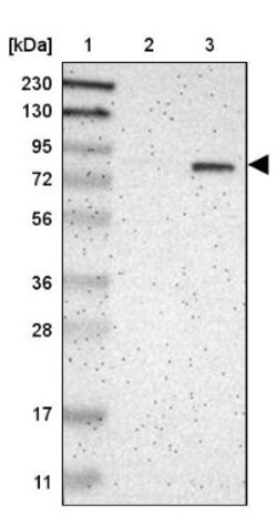 ALDH18A1 Antibody, Novus Biologicals:Antibodies:Primary Antibodies