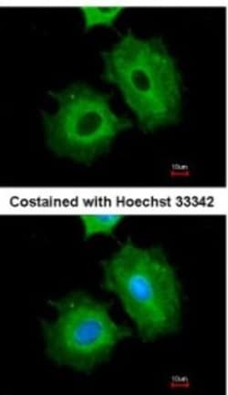 Aldehyde Dehydrogenase 1-A1/ALDH1A1 Antibody, Novus Biologicals 0.1 mL | Buy Online | Novus Biologicals | Fisher Scientific