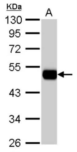 Aldehyde Dehydrogenase 1-A1/ALDH1A1 Antibody, Novus Biologicals 0.1 mL | Buy Online | Novus Biologicals | Fisher Scientific