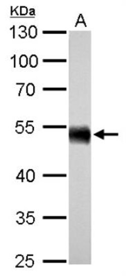 Aldehyde Dehydrogenase 1-A1/ALDH1A1 Antibody, Novus Biologicals 0.1 mL | Buy Online | Novus Biologicals | Fisher Scientific