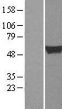 Novus Biologicals™ ALDH1A2 Overexpression Lysate