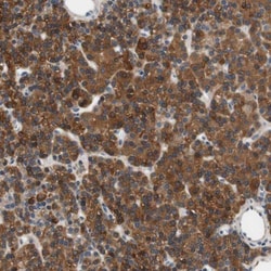 ALDH1A2 Antibody, Novus Biologicals:Antibodies:Primary Antibodies