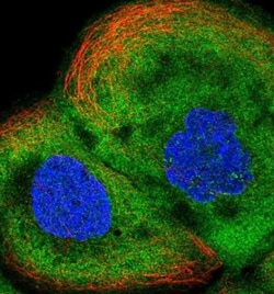ALDH1A3 Antibody, Novus Biologicals:Antibodies:Primary Antibodies